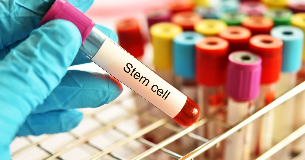 Comparing stem cell IV therapy and PRP regenerative options at iCRYO St. Johns