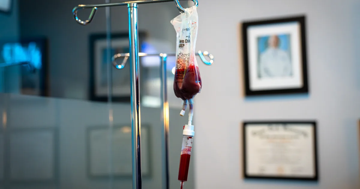 Ozone UV IV compared with a standard vitamin IV drip at iCRYO St. Johns
