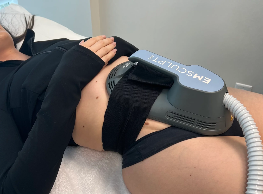 Emsculpt Neo session in progress at iCRYO St Johns