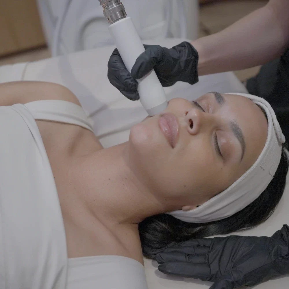 T-Shape 2 facial treatment on the cheek at iCRYO St. Johns